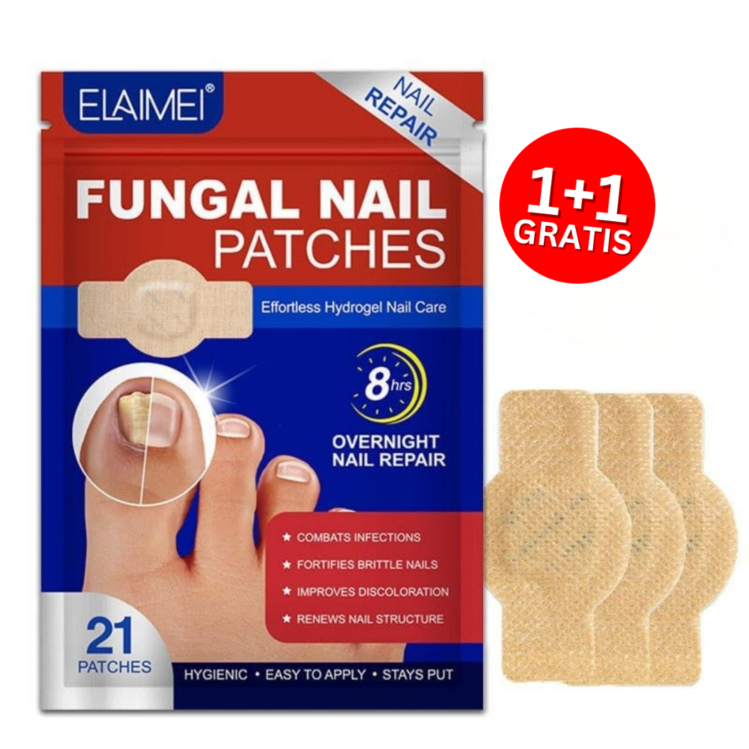 FungalPatches, restorativni flasteri za njegu oštećenih noktiju (21 kom.) (1+1 GRATIS )